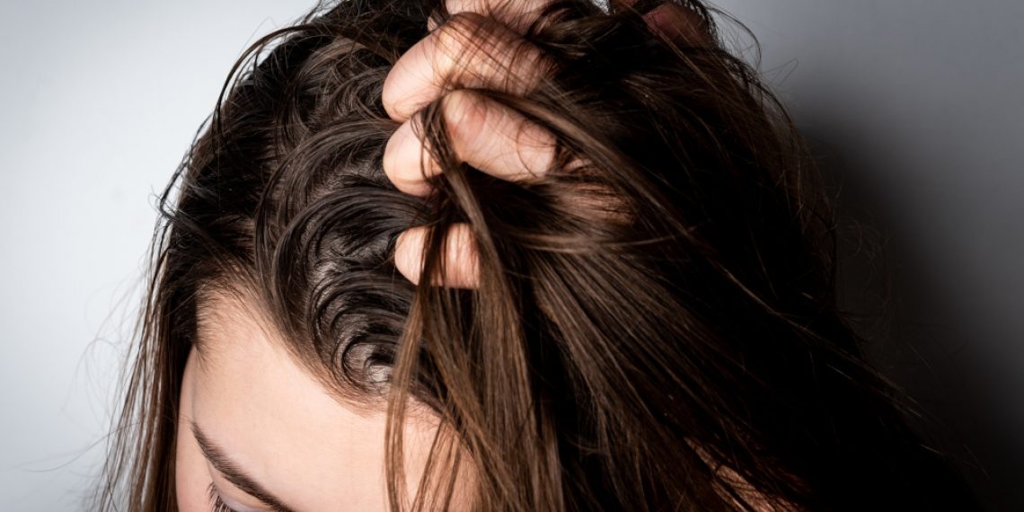 My 4 Infallible Remedies for Oily Hair